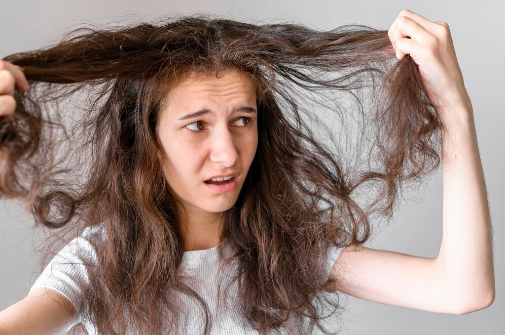 Rambut Sering Lepek, Rontok Atau Ketombean? Ini 5 Permasalahan Pada Rambut dan Cara Mengatasinya