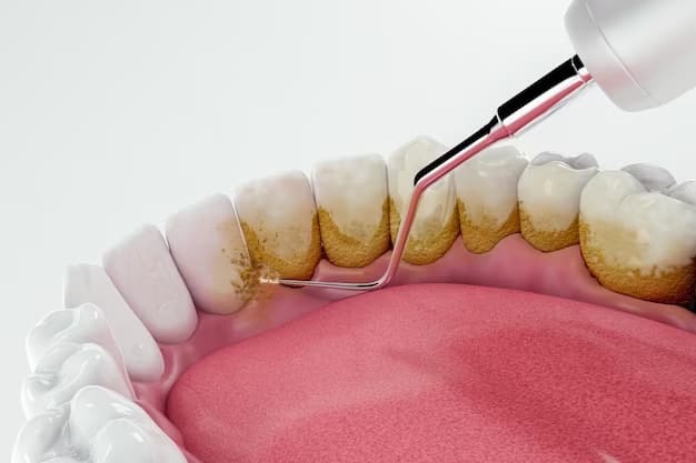 Tips Efektif Merawat Gigi agar Terhindar dari Karang Gigi