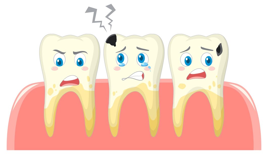 Ternyata Ini Lho 7 Faktor Penyebab Gigi Kamu Berlubang