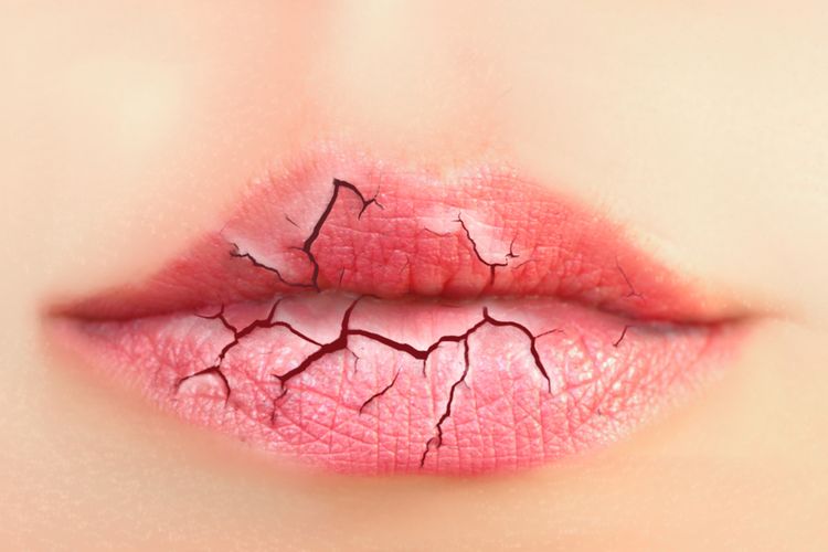 10 Tips dan Trik Mengatasi Bibir Kering di Musim Kemarau