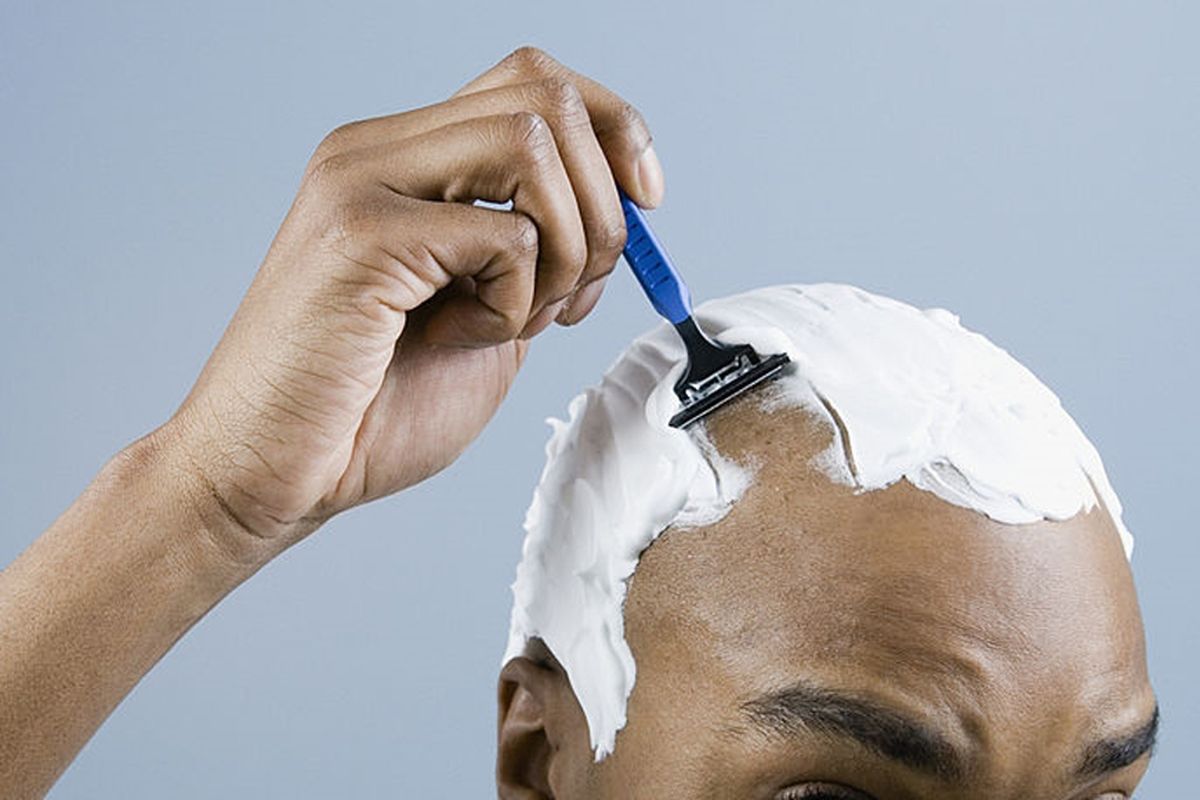 Tips dan Trik Sederhana Mencegah Botak pada Pria, Simak Penjelasannya!