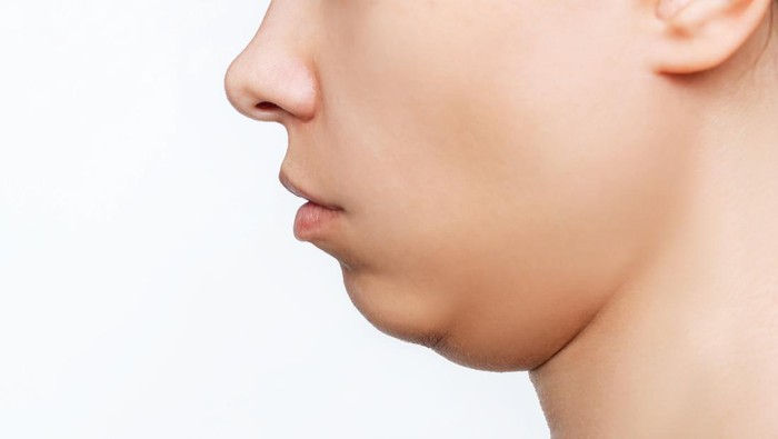 Cara Menghilangkan Double Chin dengan Mudah: Tips Efektif untuk Wajah Lebih Tirus