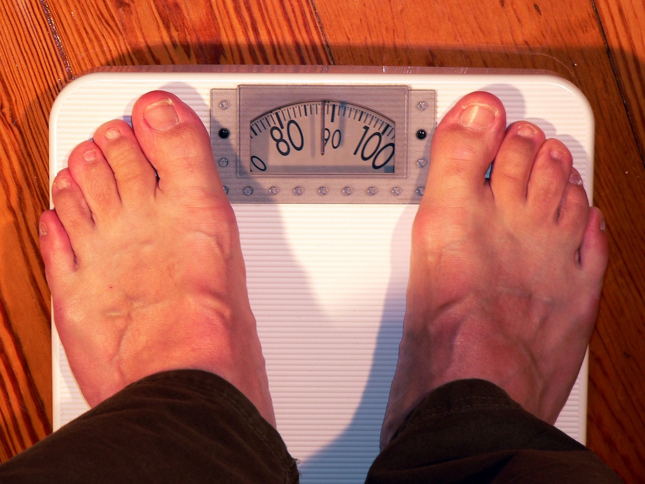 Obesitas, Kenali Bahaya Obesitas bagi Kesehatan Serta Bagaimana Cara Pencegahan Terjadinya Obesitas