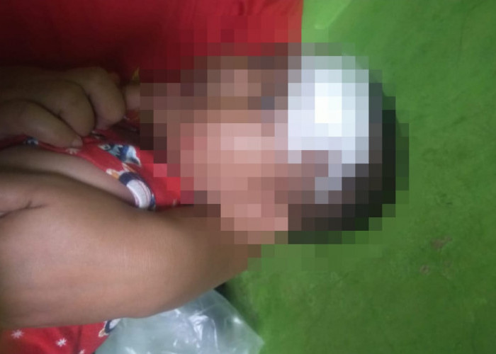 Keluarga Korban Pohon Tumbang di Pakansari Akui Belum Terima Bantuan Pemerintah