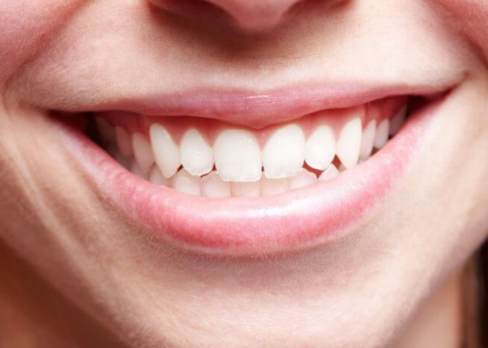 8 Cara Merawat Gigi Agar Terhindar dari Karang Gigi