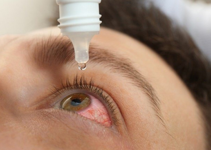 Apakah Penggunaan Obat Tetes Mata Membatalkan Puasa? Berikut Penjelasannya!
