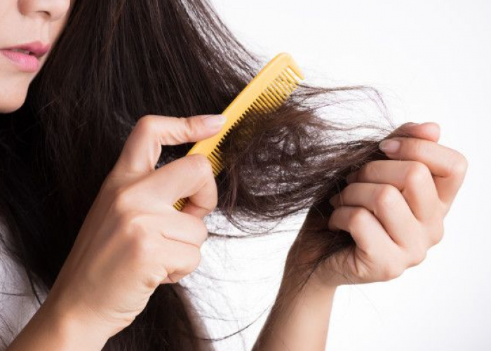 Cara Mengatasi Rambut Kering, Tips Ampuh untuk Mencegah dan Mengatasi Rambut Kering