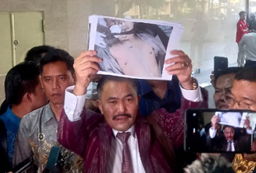 Hasil Autopsi Ulang Jenazah Brigadir J, Kamaruddin: Ada Tembakan dari Kepala Belakang hingga Tembus ke Bagian 