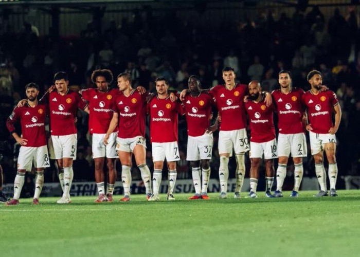 Manchester United vs Crystal Palace: 4 Pemain King MU Absen karena Cedera