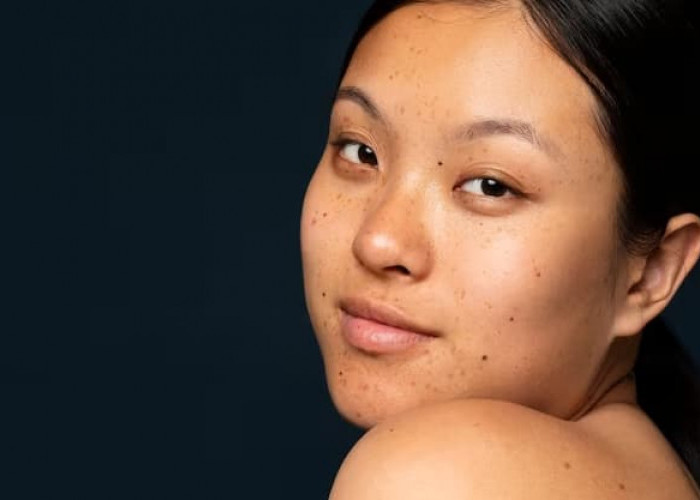 7 Rekomendari Skincare untuk Flek Hitam dari Brand Lokal yang Murah Meriah