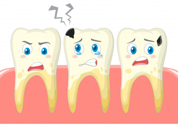 Panduan Lengkap Cara Merawat Gigi Agar Tidak Mudah Berlubang