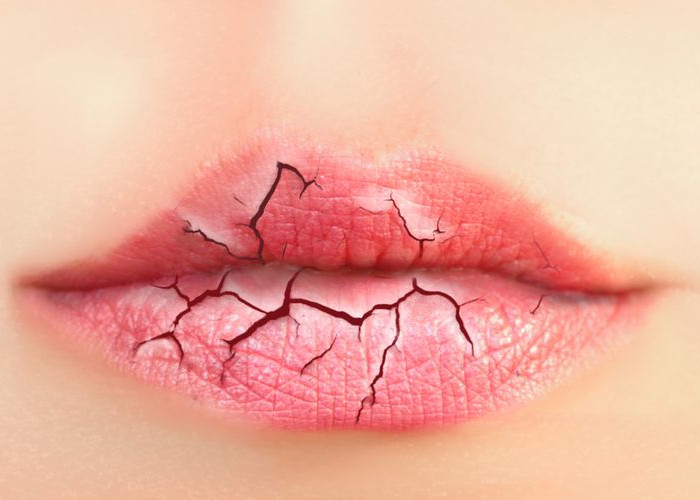 10 Tips dan Trik Mengatasi Bibir Kering di Musim Kemarau
