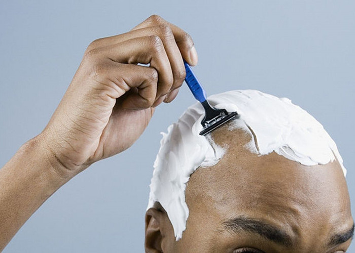 Tips dan Trik Sederhana Mencegah Botak pada Pria, Simak Penjelasannya!
