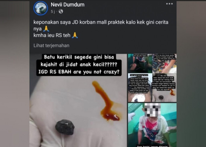Video Viral Dugaan Malpraktik di RSUD Majalaya, Batu Kerikil Tertinggal di Kening Korban