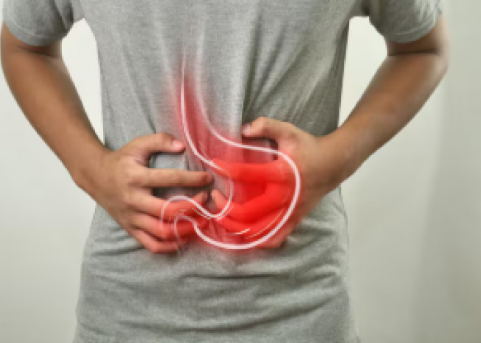 7 Cara Mencegah Asam Lambung Kambuh Saat Puasa, Ibadah Tetap Nyaman