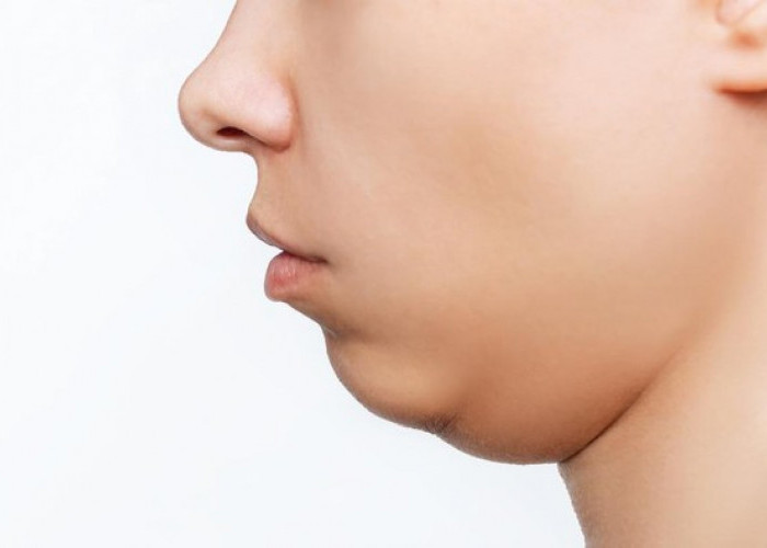 Cara Menghilangkan Double Chin dengan Mudah: Tips Efektif untuk Wajah Lebih Tirus