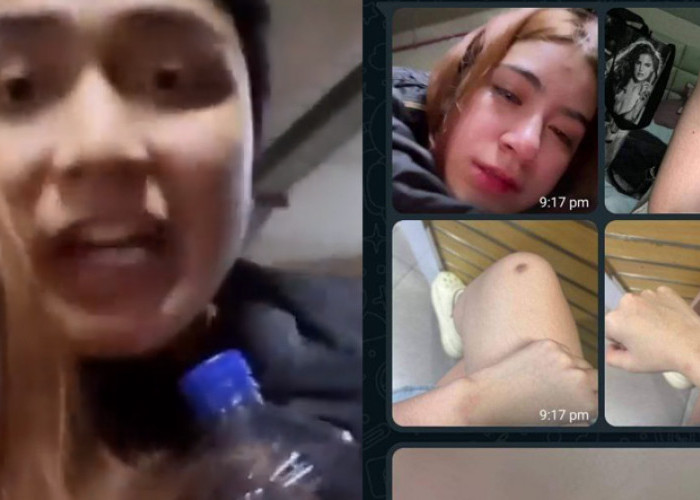 Rinoa Aurora Senduk Diduga Alami Kekerasan dari Leon Dozan, Bukti Chat dan Video Viral
