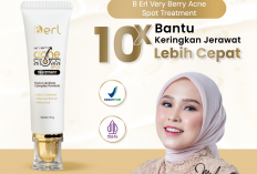 Jerawat Muncul? Oles Ini, Jangan Dipencet